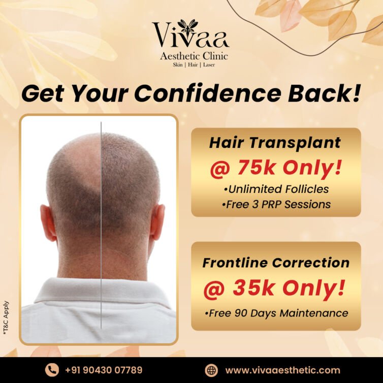 hair transplant (1)